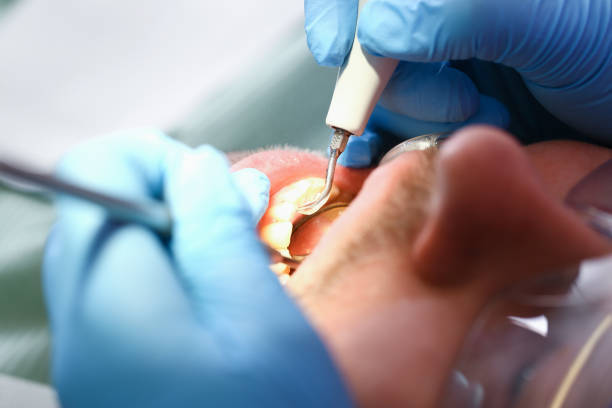 Best Emergency Gum Treatment in Orrville, OH