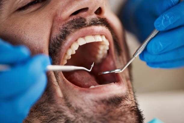 Best Emergency Tooth Extraction in Orrville, OH